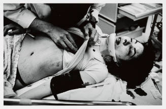 Black-and-white photograph of bruised and bleeding person with light skin tone on a hospital gurney